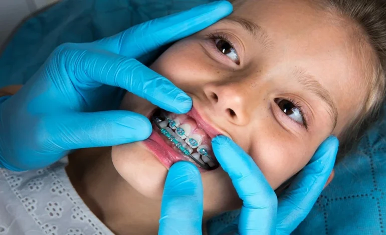 Does Every Child Need Early Orthodontic Treatment?
