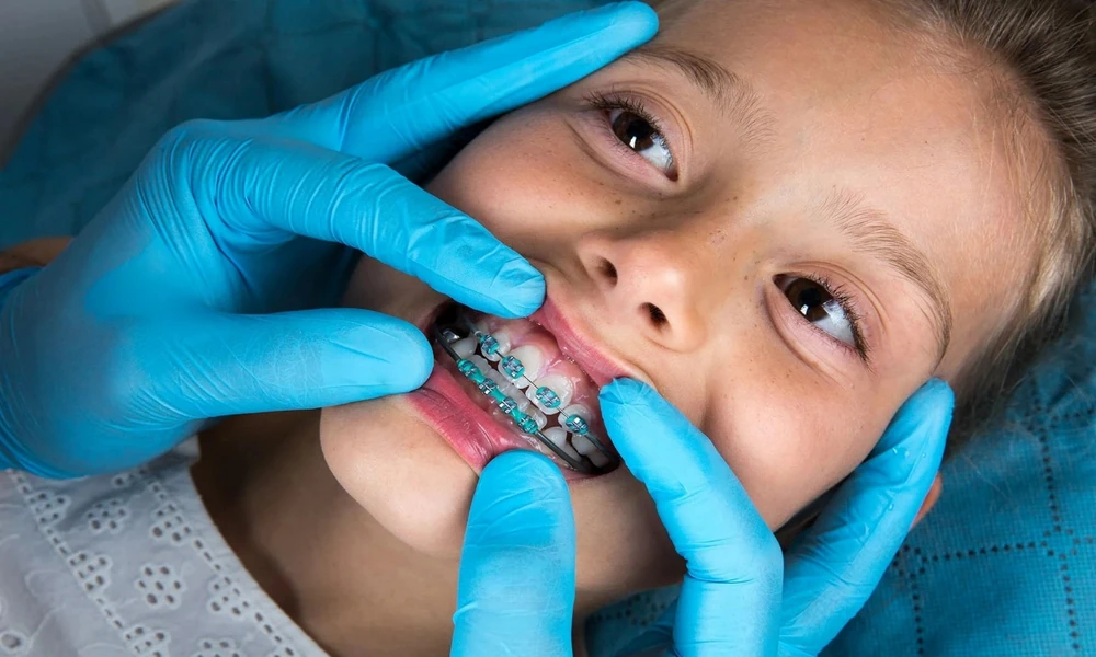 Does Every Child Need Early Orthodontic Treatment?